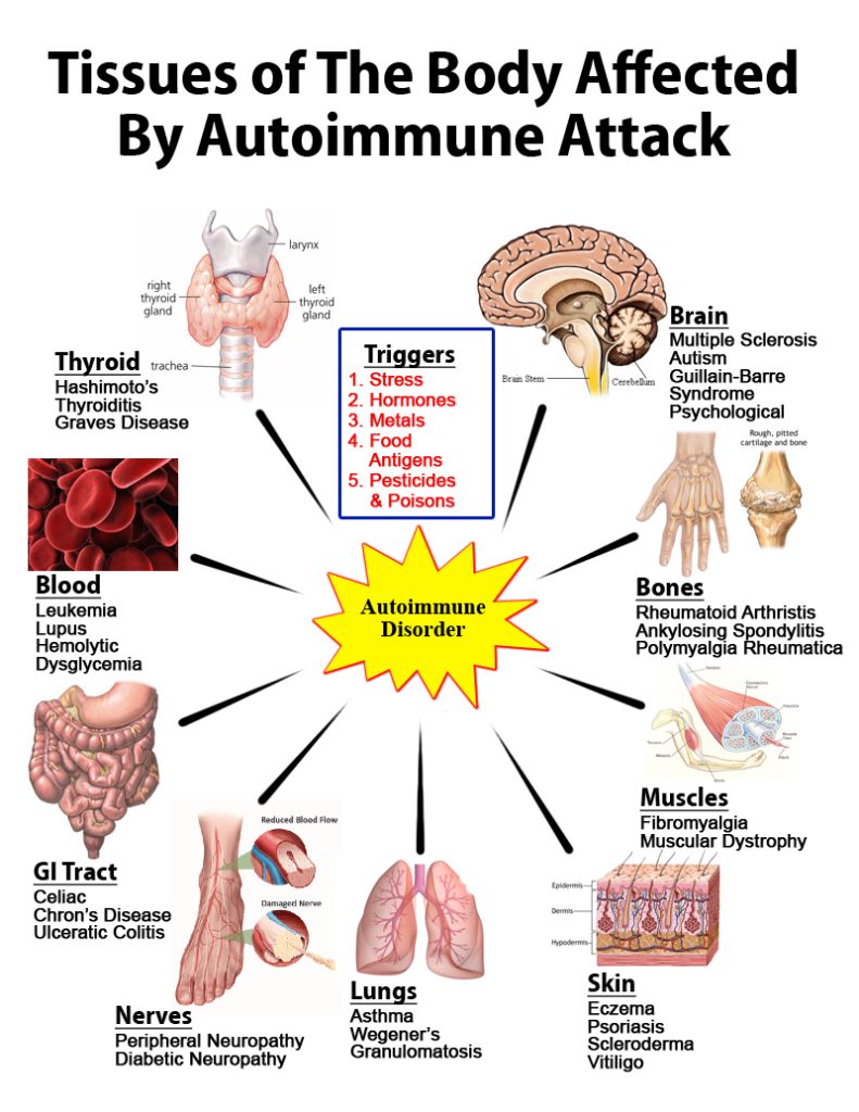 Autoimmune Diseases What You Should Know North Shore Chiropractic 