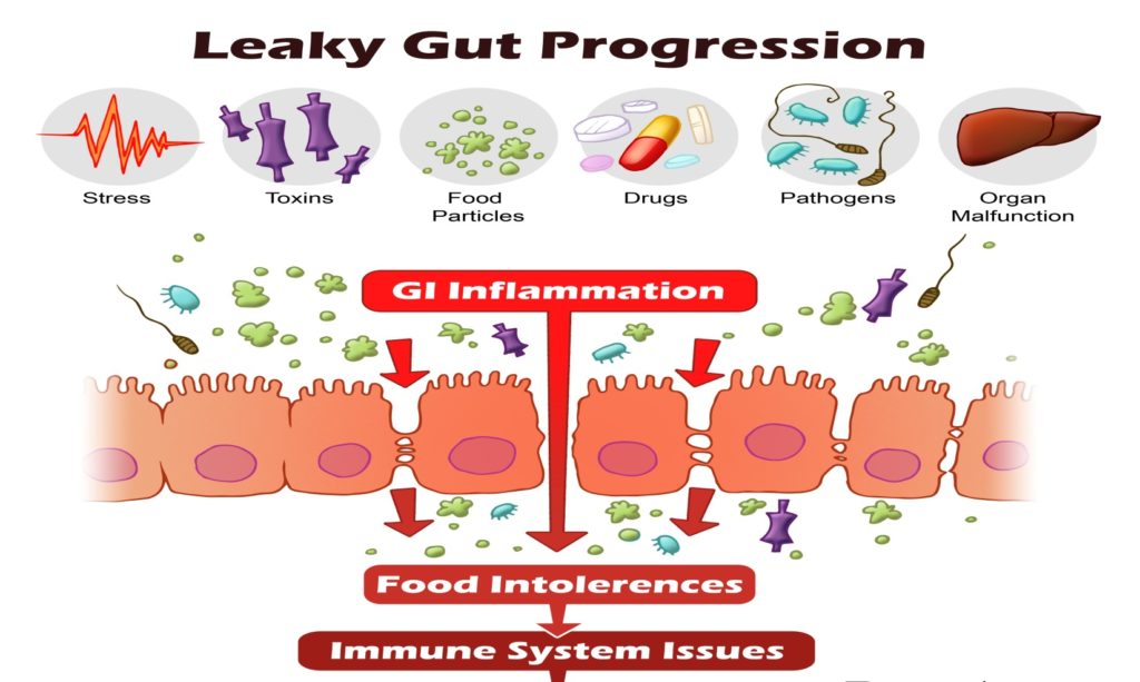 Leaky gut syndrome исследования